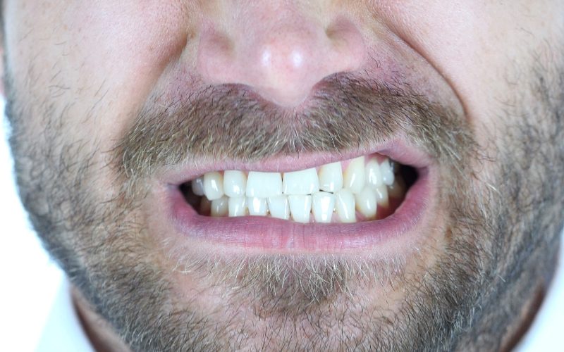 How do I Stop Grinding My Teeth in My Sleep