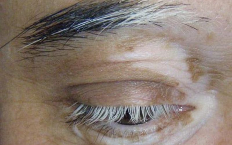 Spiritual Meaning of White Eyebrow Hair